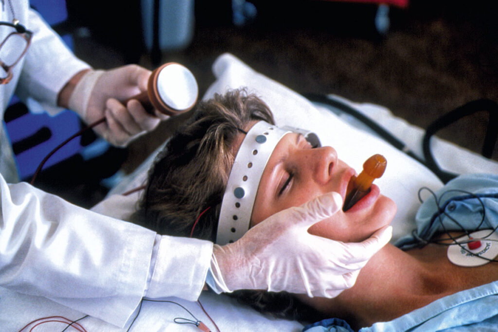 درمان شوک درمانی ECT روی زن