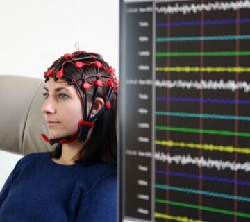 نمایشگر مغزی کنار زن بیمار با حسگرهای روی سر
